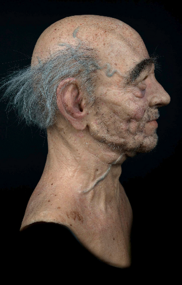 RIMUS