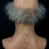 RIMUS